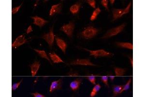 Immunofluorescence analysis of C6 cells using DNASE1L1 Polyclonal Antibody at dilution of 1:100. (DNASEX 抗体)
