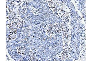IHC analysis of FACL4/ACSL4 using anti-FACL4/ACSL4 antibody (ABIN7602779).