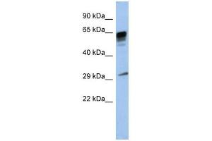 PRR18 antibody used at 1 ug/ml to detect target protein. (Proline Rich 18 抗体  (Middle Region))