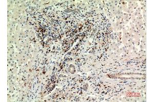 Immunohistochemistry (IHC) analysis of paraffin-embedded Human Liver, antibody was diluted at 1:100.