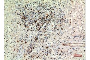Immunohistochemistry (IHC) analysis of paraffin-embedded Human Liver, antibody was diluted at 1:100. (CD74 抗体  (Internal Region))