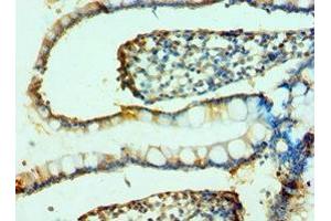 Immunohistochemistry of paraffin-embedded human small intestine tissue using ABIN7164791 at dilution of 1:100 (FAP 抗体  (AA 26-280))