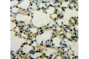 Used in DAB staining on fromalin fixed paraffin-embedded Lung tissue (IL1A 抗体  (AA 116-270))