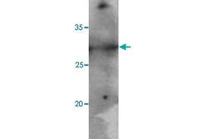 Jurkat cell lysates (40 ug) were resolved by SDS-PAGE, transferred to PVDF membrane and probed with PNMT monoclonal antibody, clone AT1C11  (1:500). (PNMT 抗体  (AA 1-282))