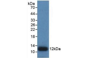 Detection of Recombinant IL8, Human using Monoclonal Antibody to Interleukin 8 (IL8) (IL-8 抗体  (AA 28-99))