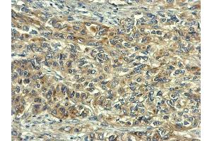 Immunohistochemistry (IHC) image for anti-V-Rel Reticuloendotheliosis Viral Oncogene Homolog B (RELB) (C-Term) antibody (ABIN2855360)