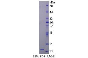 SDS-PAGE analysis of Human HOP Protein.