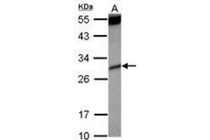 Image no. 2 for anti-Killer Cell Immunoglobulin-Like Receptor, Two Domains, Short Cytoplasmic Tail, 4 (KIR2DS4) (AA 1-294) antibody (ABIN1499052) (KIR2DS4 抗体  (AA 1-294))