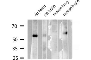 Western blot analysis of RUNX2 expression in various lysates (RUNX2 抗体  (Internal Region))