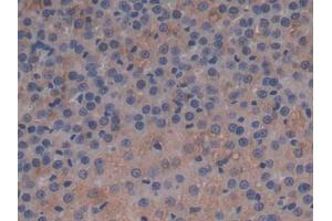 DAB staining on IHC-P; Samples: Rat Adrenal gland Tissue (APOC1 抗体  (AA 34-88))