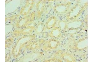 Immunohistochemistry of paraffin-embedded human kidney tissue using ABIN7148336 at dilution of 1:100 (C1QB 抗体  (AA 104-253))