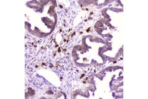 IHC analysis of Ribonuclease 3 using anti-Ribonuclease 3 antibody (ABIN5693221). (RNASE3 抗体  (AA 28-160))