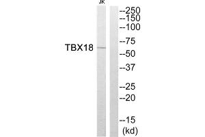 Western blot analysis of extracts from Jurkat cells, using TBX18 antibody. (T-Box 18 抗体  (Internal Region))