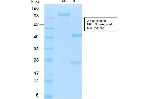 SDS-PAGE Analysis of Purified MUC16 Rabbit Recombinant Monoclonal Antibody (OCA125/2349R). (Recombinant MUC16 抗体)