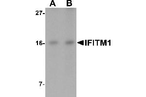 Western blot analysis of IFITM1 in Jurkat cell lysate with IFITM1 antibody at (A) 2.