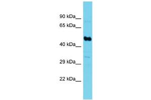 Western Blotting (WB) image for anti-Succinate-CoA Ligase, GDP-Forming, beta Subunit (SUCLG2) (N-Term) antibody (ABIN2790591) (SUCLG2 抗体  (N-Term))