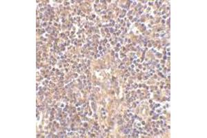 Immunohistochemistry of ATM in human lymph node tissue with this product atM antibody at 2. (ATM 抗体  (C-Term))