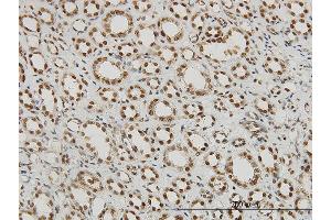 Immunostaining (ISt) image for anti-Regulation of Nuclear Pre-mRNA Domain Containing 1A (RPRD1A) (AA 76-170) antibody (ABIN565840)