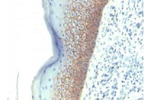 Formalin-fixed, paraffin-embedded human skin stained with E-Cadherin antibody (CDH1/1525). (E-cadherin 抗体)