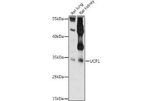 Western blot analysis of extracts of various cell lines, using UCP1 antibody  at 1:1000 dilution.