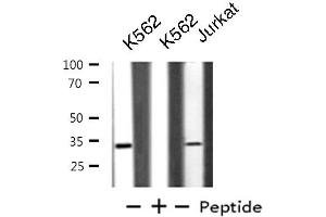 Western blot analysis of extracts from K562/Jurkat cells, using BTLA antibody. (BTLA 抗体  (C-Term))