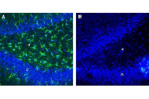 Expression of CLEC7A/Dectin-1 in rat hippocampus.
