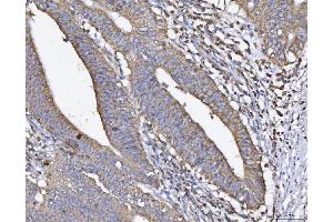 IHC analysis of ATP5H using anti-ATP5H antibody (ABIN3043795).