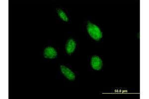 Immunofluorescence of purified MaxPab antibody to OVOL2 on HeLa cell. (OVOL2 抗体  (AA 1-275))