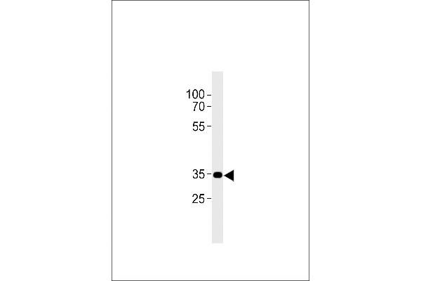 CNR2 抗体  (C-Term)