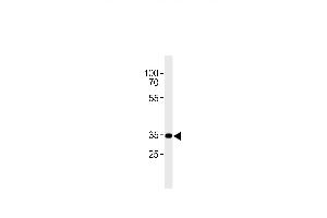 CB2 Antibody (C-term) (ABIN654631 and ABIN2844327) western blot analysis in A431 cell line lysates (35 μg/lane). (CNR2 抗体  (C-Term))