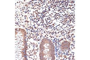 Immunohistochemistry of paraffin-embedded human appendix using K/MYST1/MOF Rabbit mAb (ABIN7268063) at dilution of 1:100 (40x lens). (MYST1 抗体)