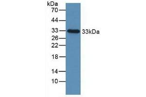 IGFBP2 抗体  (AA 148-325)
