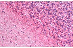 Immunohistochemistry analysis of paraffin-embedded Human Cerebellum using GAP43 Polyclonal Antibody. (GAP43 抗体)