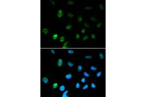 Immunofluorescence analysis of HepG2 cell using CGA antibody. (CGA 抗体  (AA 25-116))