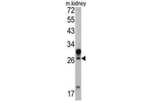 Western blot analysis of HOXA5 antibody (C-term E211) in mouse kidney tissue lysates (35ug/lane). (HOXA5 抗体  (C-Term))