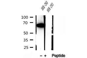 Western blot analysis of extracts of HEK-293 cells, using METTL3 antibody. (METTL3 抗体)