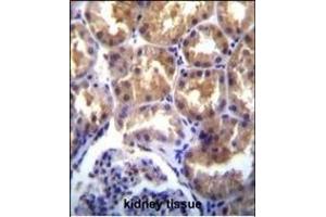 TR(CHAK2) Antibody (Center) (ABIN392616 and ABIN2842133) immunohistochemistry analysis in formalin fixed and paraffin embedded human kidney tissue followed by peroxidase conjugation of the secondary antibody and DAB staining. (TRPM6 抗体  (AA 317-348))