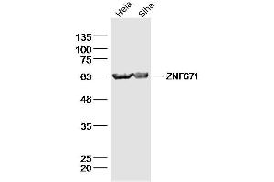 Lane 1: Hela lysates Lane 2: Siha lysates probed with ZNF671 Polyclonal Antibody, Unconjugated  at 1:300 dilution and 4˚C overnight incubation. (ZNF671 抗体  (AA 101-200))