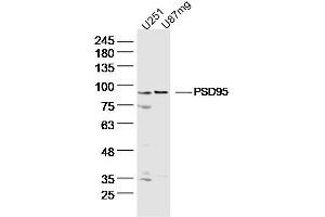 Lane 1: U251 lysates Lane 2: U87mg lysates probed with DLG4 Polyclonal Antibody, Unconjugated  at 1:300 dilution and 4˚C overnight incubation. (DLG4 抗体  (AA 351-450))
