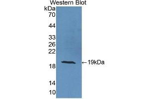 Detection of Recombinant CRABP2, Human using Polyclonal Antibody to Cellular Retinoic Acid Binding Protein 2 (CRABP2) (CRABP2 抗体  (AA 1-138))