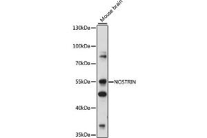 Western blot analysis of extracts of various cell lines, using NOSTRIN antibody (ABIN7268922) at 1:1000 dilution. (NOSTRIN 抗体  (AA 207-506))