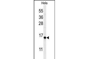 Western blot analysis of GABARL1 Antibody 9133a in Hela cell line lysates (35 μg/lane). (GABARAPL1 抗体)