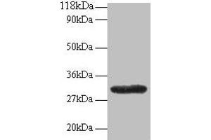 Western blot All lanes: GPR161 antibody at 2 μg/mL + EC109 whole cell lysate Secondary Goat polyclonal to rabbit IgG at 1/15000 dilution Predicted band size: 59, 46, 44, 50, 47, 61 kDa Observed band size: 30 kDa (GPR161 抗体  (AA 1-28))