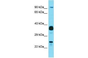 Western Blotting (WB) image for anti-Josephin Domain Containing 1 (JOSD1) (N-Term) antibody (ABIN2791598) (JOSD1 抗体  (N-Term))