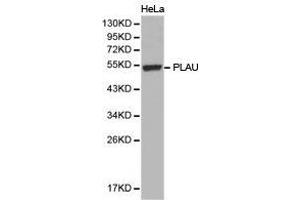 Western Blotting (WB) image for anti-Plasminogen Activator, Urokinase (PLAU) antibody (ABIN1874158) (PLAU 抗体)