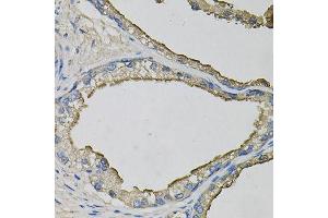 Immunohistochemistry of paraffin-embedded human prostate using LCN1 antibody (ABIN6003560) at dilution of 1/100 (40x lens). (Lipocalin 1 抗体)