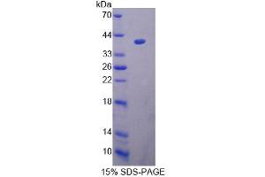 SDS-PAGE (SDS) image for Uridine Phosphorylase 2 (UPP2) (AA 1-320) protein (His tag) (ABIN6239566)