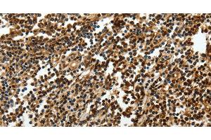 Immunohistochemistry of paraffin-embedded Human tonsil using SOX-13 Polyclonal Antibody at dilution of 1:50 (SOX13 抗体)