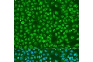 Immunofluorescence analysis of U2OS cells using Phospho-BRCA1(S1423) Polyclonal Antibody at dilution of 1:100. (BRCA1 抗体  (pSer1423))