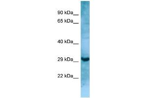 WB Suggested Anti-MASP1 Antibody Titration: 1. (MASP1 抗体  (N-Term))